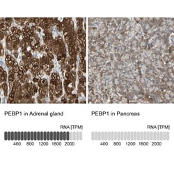 RKIP/PBP Antibody, Novus Biologicals 0.1mL; Unlabeled:Antibodies, Polyclonal